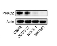 PRKCZ expression in each cell line.jpg